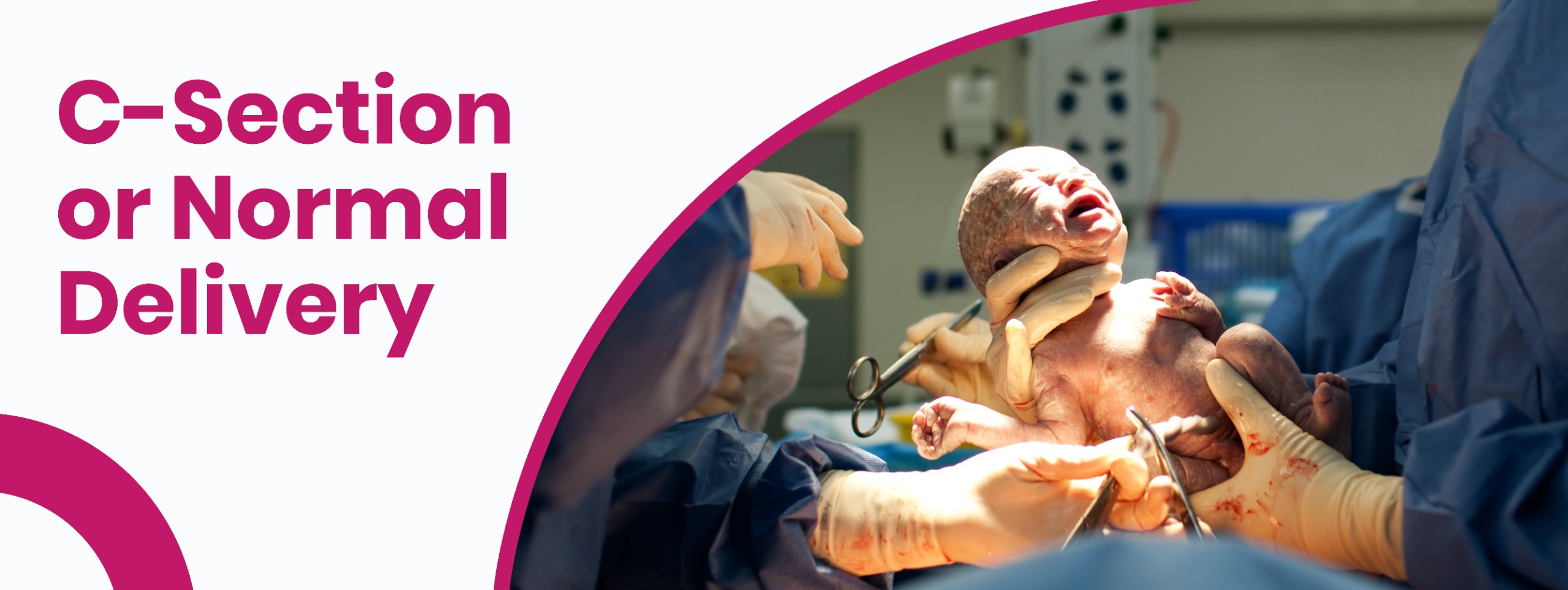 Normal delivery vs c- section